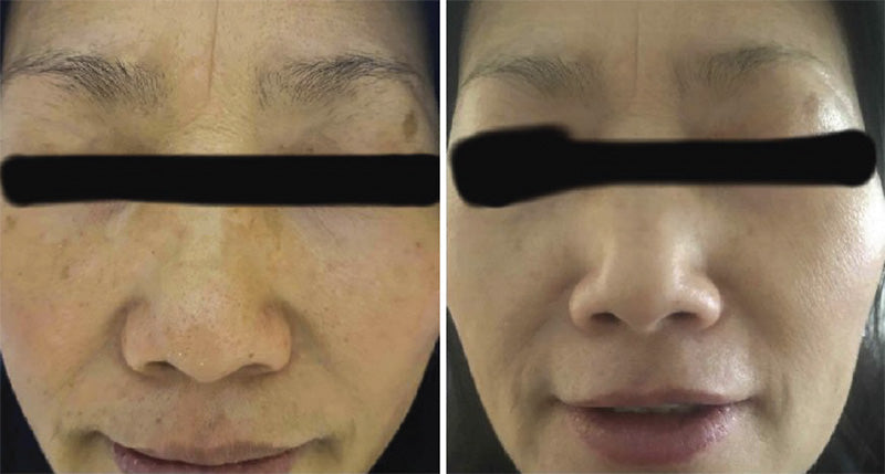 Pagrindiniai sausos odos gydymo principai