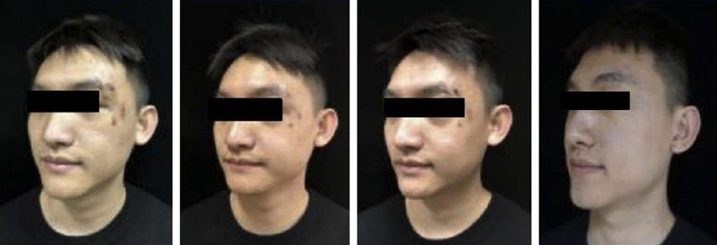 Pagrindiniai trauminių sužeidimų gydymo principai