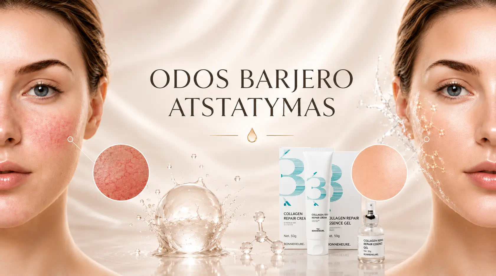 Odos barjero atstatymas