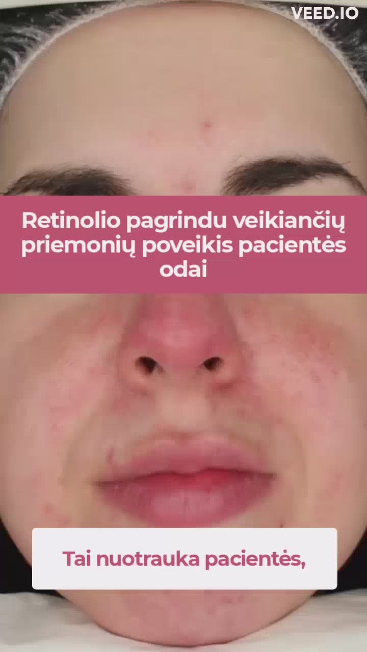 Seacra Raudonųjų dumblių odą regeneruojantis gelis. Efektyvi pagalba nuo retinolio alergijos.