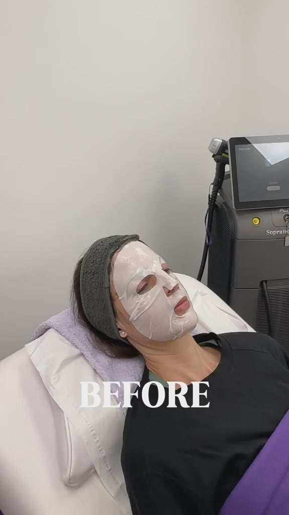 Luna Microcare 2 žingsnių gilaus drėkinimo lakštinė kaukė su serumu ROSSA. Vaizdo įrašas 5